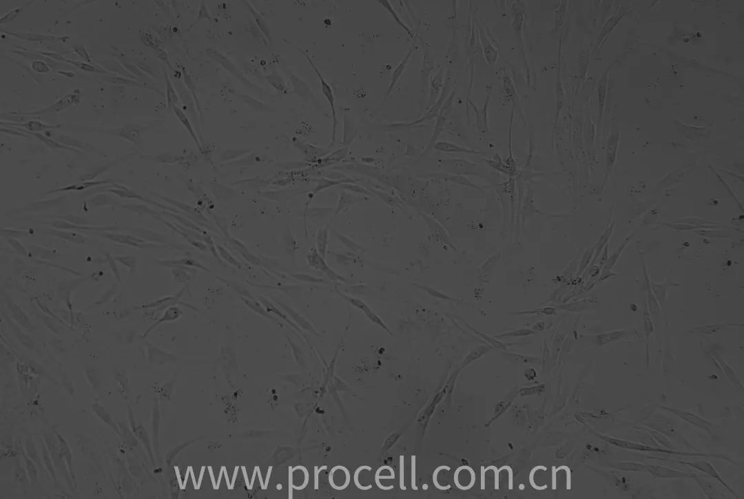 第1代人軟骨細胞狀態(tài)圖 第1代人軟骨細胞狀態(tài)圖