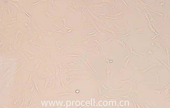 第2代人軟骨細胞狀態(tài)圖 第2代人軟骨細胞狀態(tài)圖