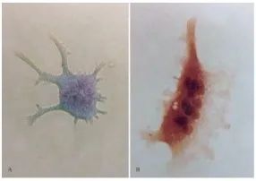 破骨細胞形態(tài) 破骨細胞形態(tài)