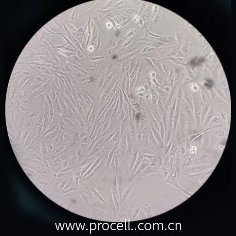 BEAS2B細胞形態(tài) BEAS2B細胞形態(tài)