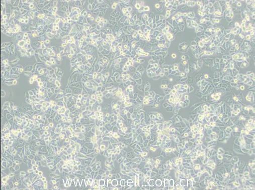 SK-BR-3細(xì)胞正常生長(zhǎng)圖 SK-BR-3細(xì)胞正常生長(zhǎng)圖