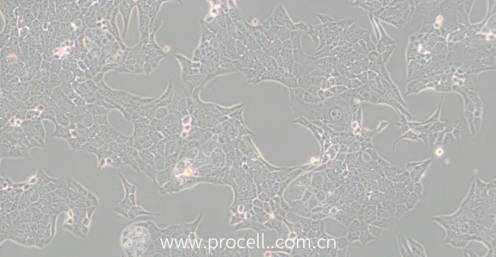 調(diào)整后的Renca細(xì)胞形態(tài) 調(diào)整后的Renca細(xì)胞形態(tài)