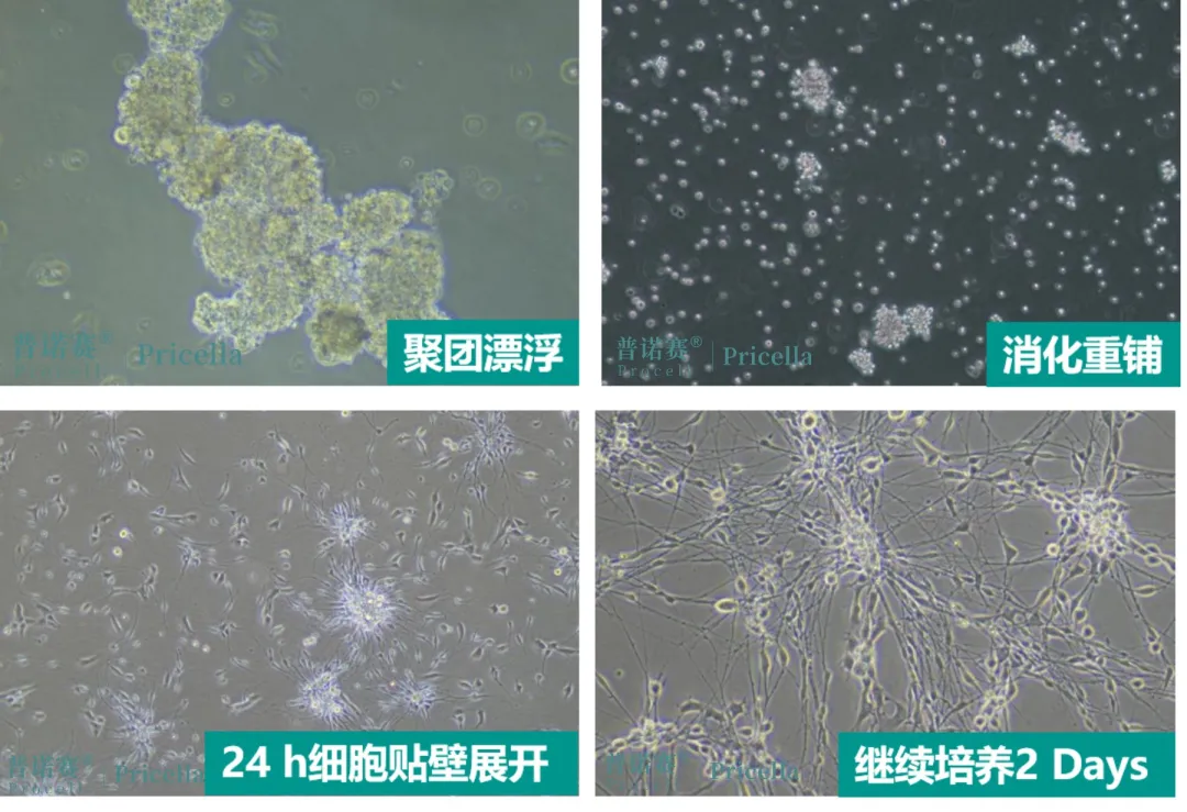 大鼠背根神經(jīng)元細胞常溫運輸后的聚團處理 大鼠背根神經(jīng)元細胞常溫運輸后的聚團處理