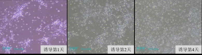 神經(jīng)干細(xì)胞誘導(dǎo)分化為星形膠質(zhì)細(xì)胞的形態(tài)變化