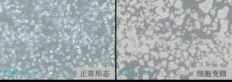 L-929細胞正常生長形態(tài)和因血清質(zhì)量差導(dǎo)致細胞變圓