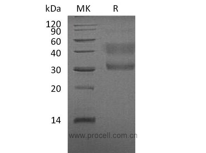 HGF R/ c-Met/ HGFR (Glu25-Gly519), Human, Recombinant
