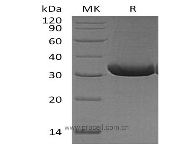 RANKL/TRANCE/TNFSF11 (N-6His), Mouse, Recombinant
