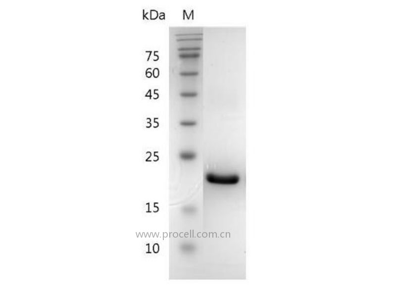 G-CSF/CSF-3/MGI-1G/pluripoietin, Mouse, Recombinant