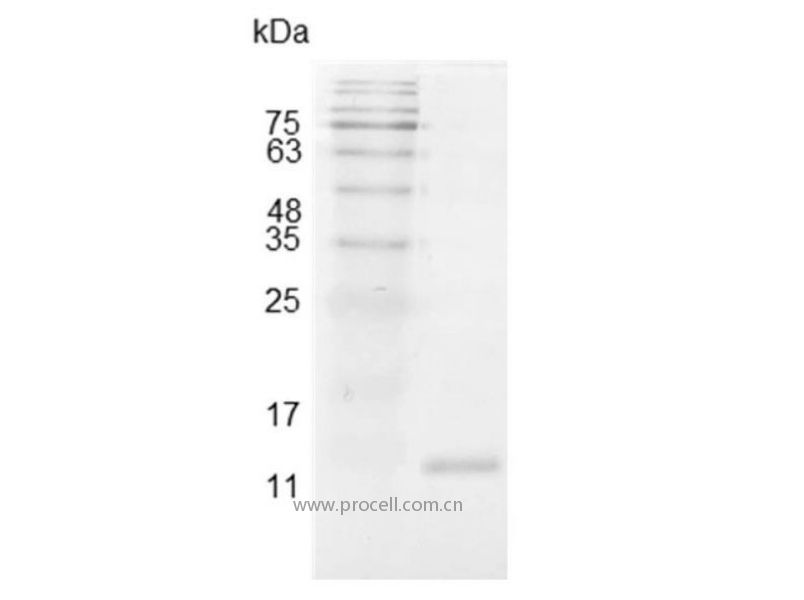 IL-2/TCGF/Aldesleukin, Swine, Recombinant