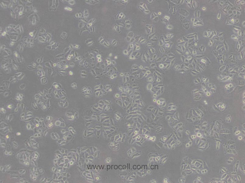 Acc-2 (人涎腺腺樣囊性癌細(xì)胞) (Hela污染細(xì)胞系，暫不供應(yīng))