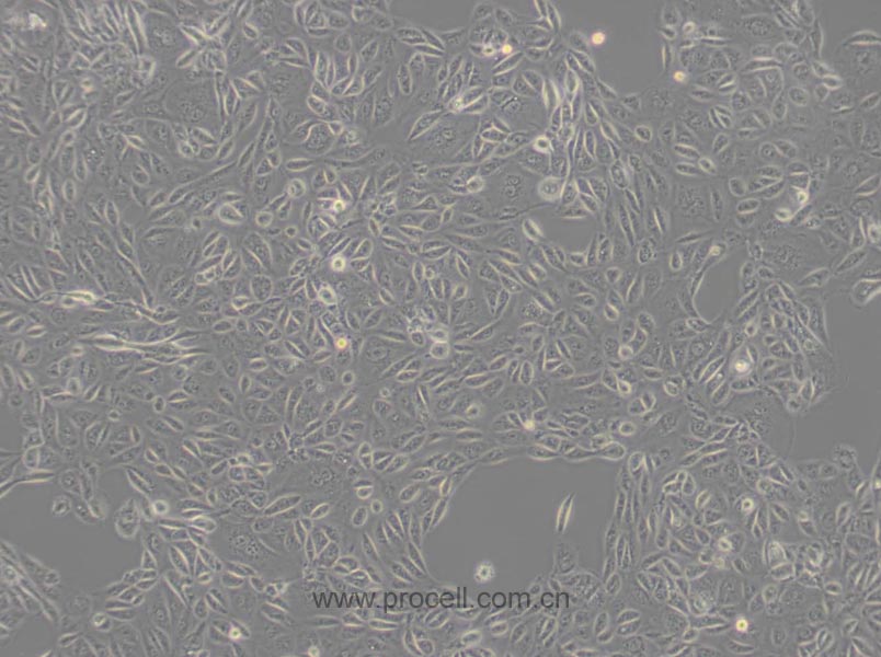 ACHN (人腎細胞腺癌細胞) (STR鑒定正確)