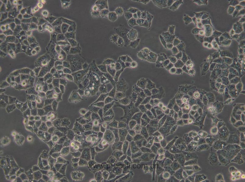 C-33 A (人子宮頸癌細(xì)胞) (STR鑒定正確)