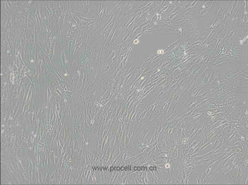 CCD-1095Sk (人乳腺浸潤性導(dǎo)管癌旁皮膚細(xì)胞) (STR鑒定正確)