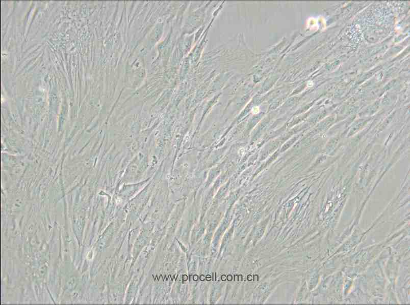 CCD-1095Sk (人乳腺浸潤性導(dǎo)管癌旁皮膚細胞) (STR鑒定正確)