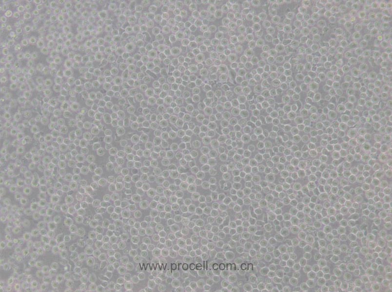CCRF-CEM [CCRF CEM] (人急性淋巴細(xì)胞白血病T淋巴細(xì)胞) (STR鑒定正確)