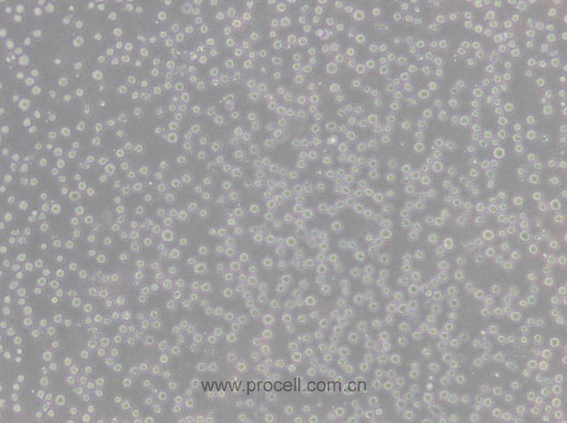 CCRF-CEM [CCRF CEM] (人急性淋巴細(xì)胞白血病T淋巴細(xì)胞) (STR鑒定正確)