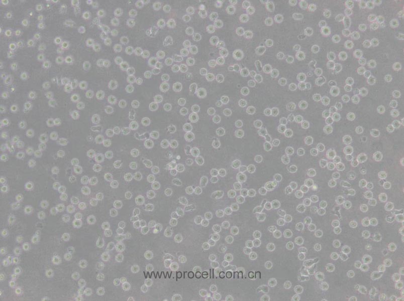 CCRF-CEM [CCRF CEM] (人急性淋巴細(xì)胞白血病T淋巴細(xì)胞) (STR鑒定正確)
