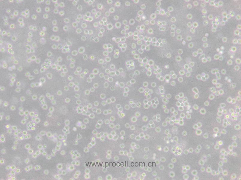 CCRF-CEM [CCRF CEM] (人急性淋巴細(xì)胞白血病T淋巴細(xì)胞) (STR鑒定正確)