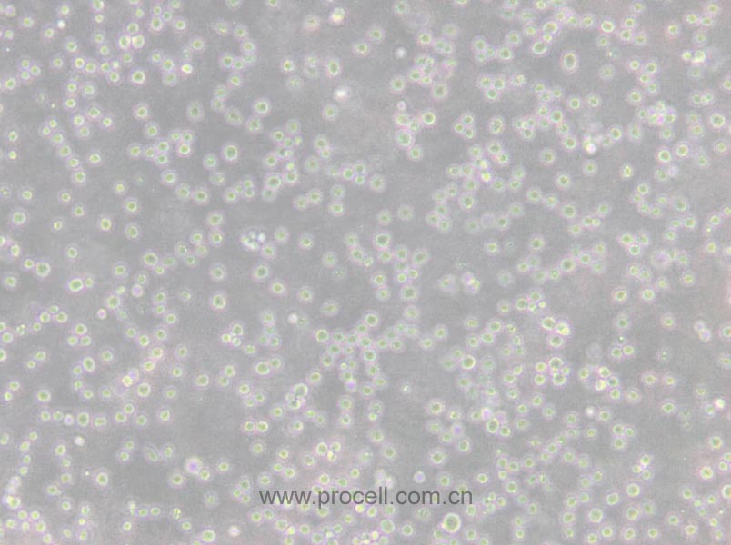 CCRF-CEM [CCRF CEM] (人急性淋巴細(xì)胞白血病T淋巴細(xì)胞) (STR鑒定正確)