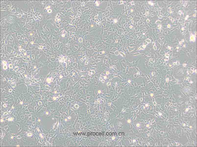 COS-1 (非洲綠猴SV40轉(zhuǎn)化的腎細胞) (種屬鑒定正確)