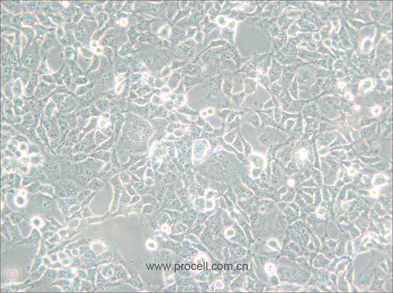 COS-1 (非洲綠猴SV40轉(zhuǎn)化的腎細胞) (種屬鑒定正確)