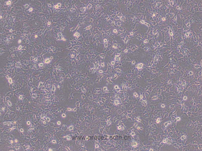 COS-7 (非洲綠猴SV40轉(zhuǎn)化的腎細(xì)胞)