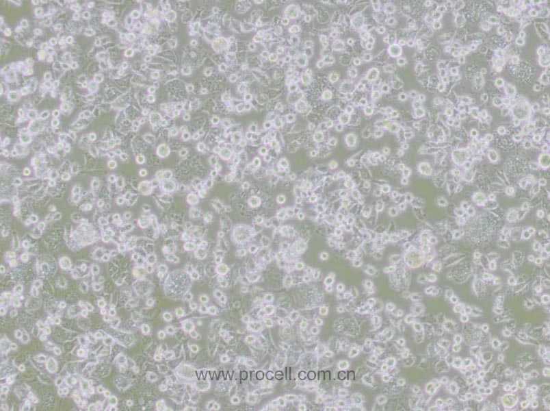 DH82 (犬巨噬細(xì)胞/狗腎惡性組織細(xì)胞增生癥細(xì)胞)(種屬鑒定正確)
