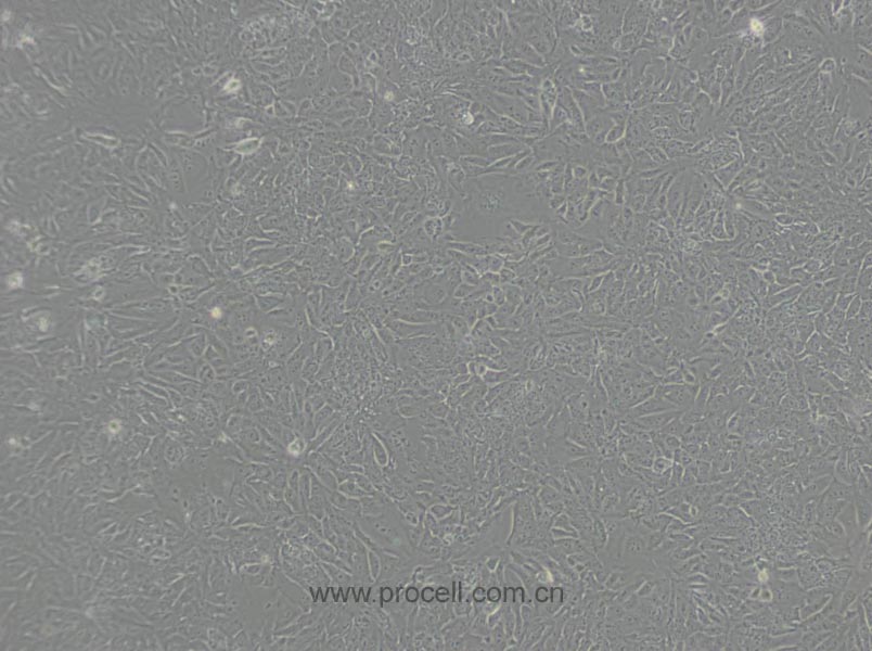 DLD-1 (人結(jié)直腸腺癌上皮細胞) (STR鑒定正確)
