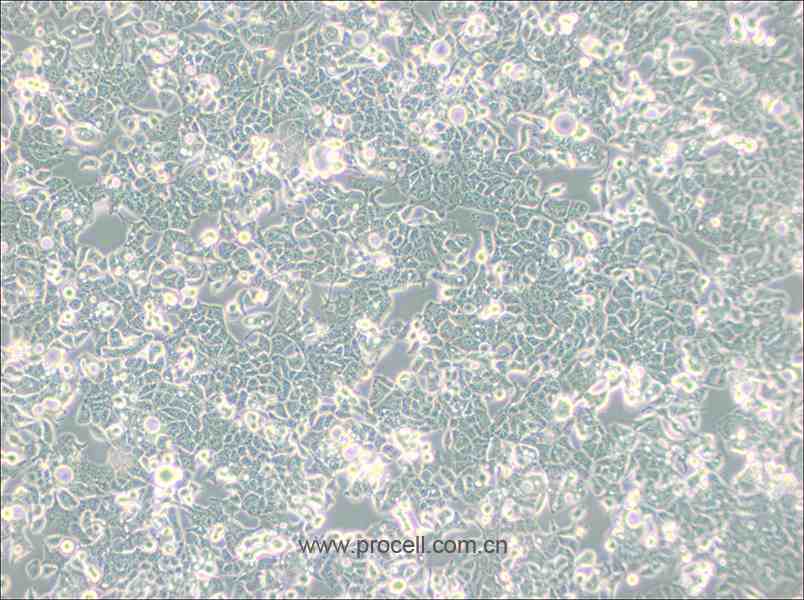 HEC-1-B (人子宮內(nèi)膜腺癌細胞) (STR鑒定正確)