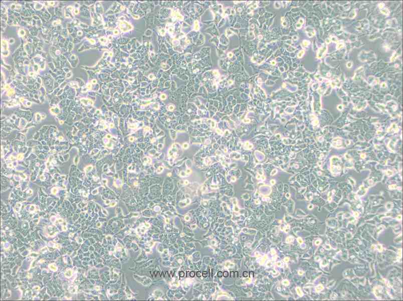 HEC-1-B (人子宮內(nèi)膜腺癌細胞) (STR鑒定正確)