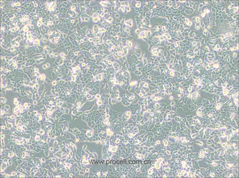 HEC-1-B (人子宮內(nèi)膜腺癌細胞) (STR鑒定正確)