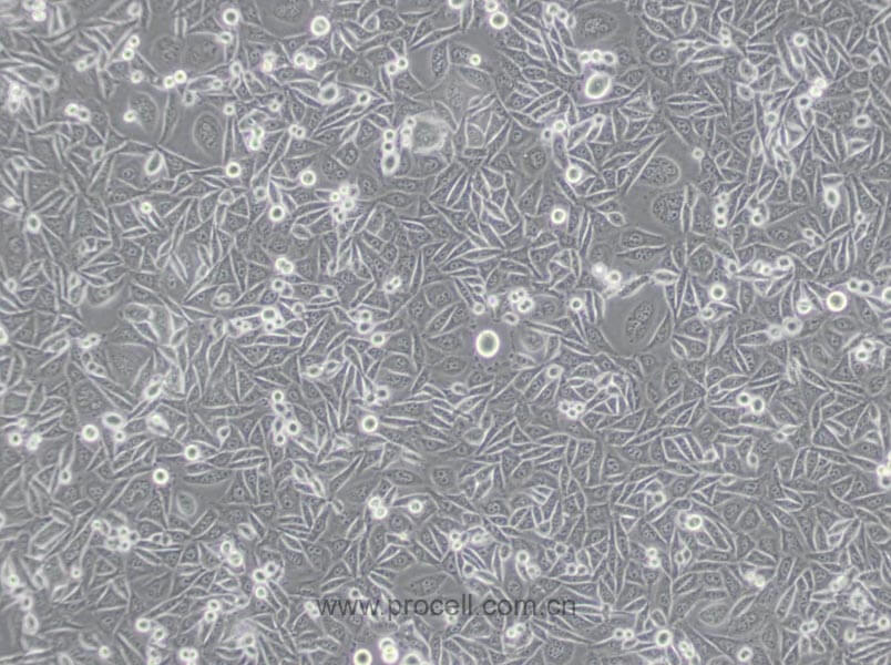 MGC80-3 [MGC-803] (人胃癌細(xì)胞) (Hela污染細(xì)胞系，暫不供應(yīng))