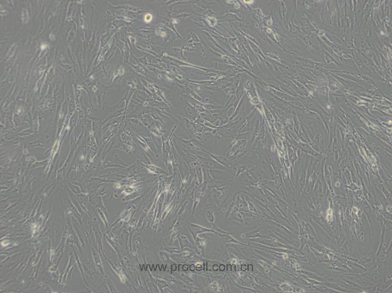 MRC-5 (人胚肺細(xì)胞) (STR鑒定正確)