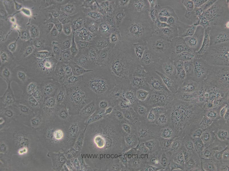 NCI-H1650 (人非小細(xì)胞肺癌細(xì)胞) (STR鑒定正確)