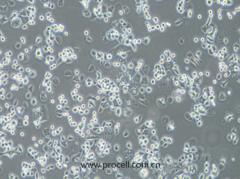 Neuro-2a [N2a; Neuro-2a] (小鼠腦神經(jīng)瘤細胞) (STR鑒定正確)