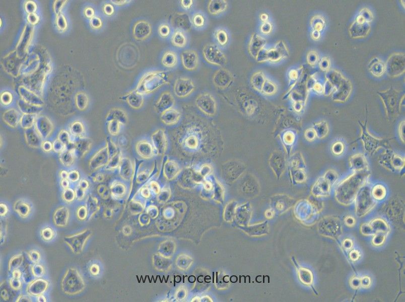 Neuro-2a [N2a; Neuro-2a] (小鼠腦神經(jīng)瘤細胞) (STR鑒定正確)