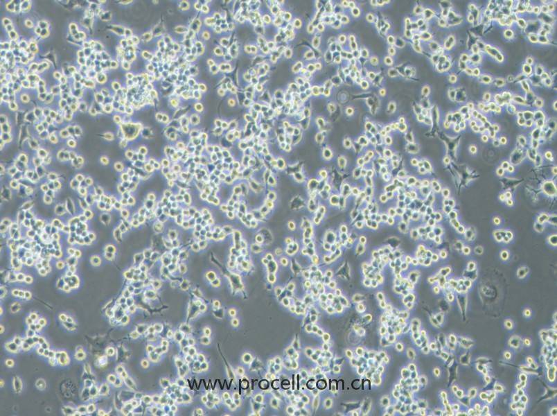 Neuro-2a [N2a; Neuro-2a] (小鼠腦神經(jīng)瘤細胞) (STR鑒定正確)