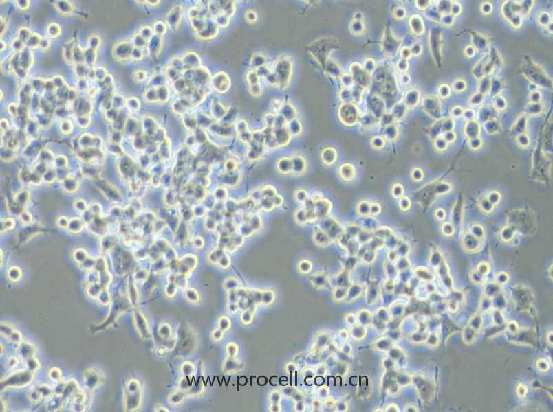 Neuro-2a [N2a; Neuro-2a] (小鼠腦神經(jīng)瘤細胞) (STR鑒定正確)