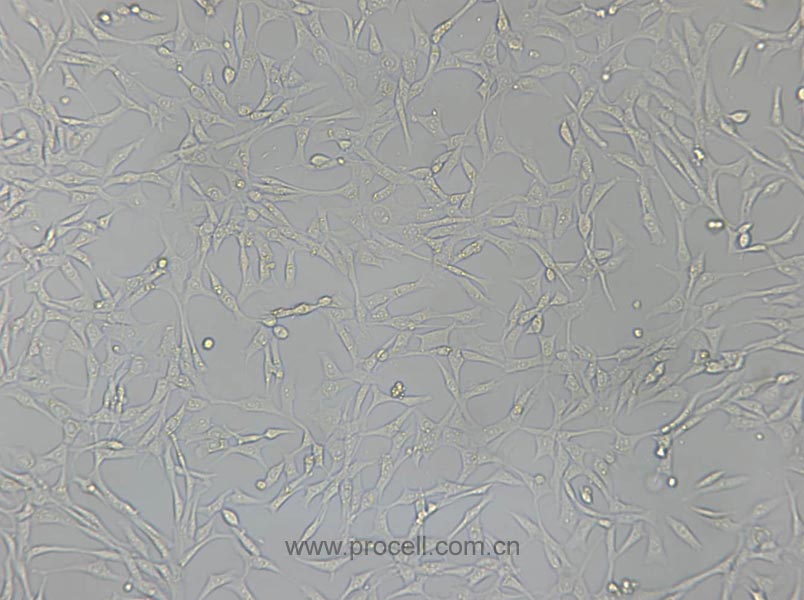 PA317 (小鼠成纖維細(xì)胞)(暫不出售）