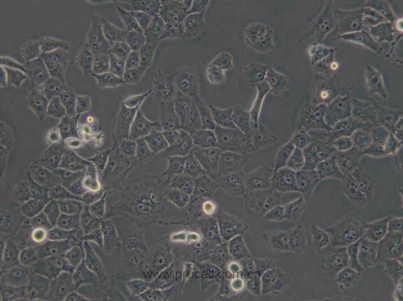 PANC-1 (人胰腺癌細(xì)胞) (STR鑒定正確)