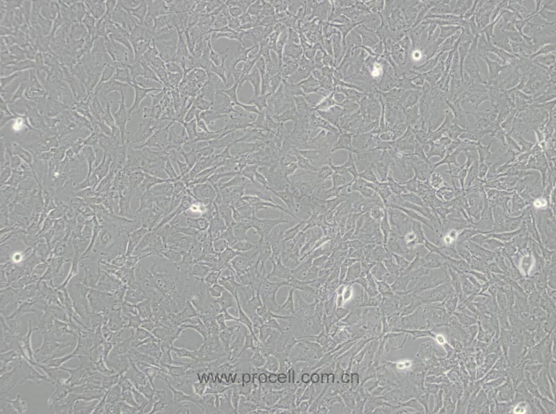 SW579 [SW 579; SW-579] (人甲狀腺鱗癌細(xì)胞) (STR鑒定正確)