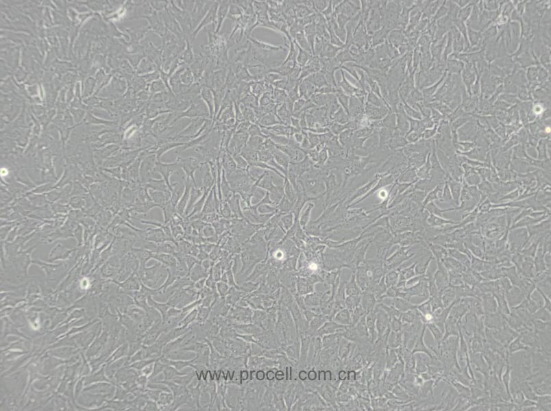 SW579 [SW 579; SW-579] (人甲狀腺鱗癌細胞) (STR鑒定正確)