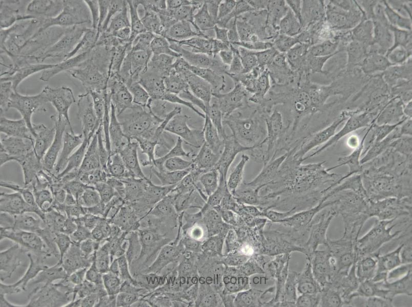 SW579 [SW 579; SW-579] (人甲狀腺鱗癌細胞) (STR鑒定正確)