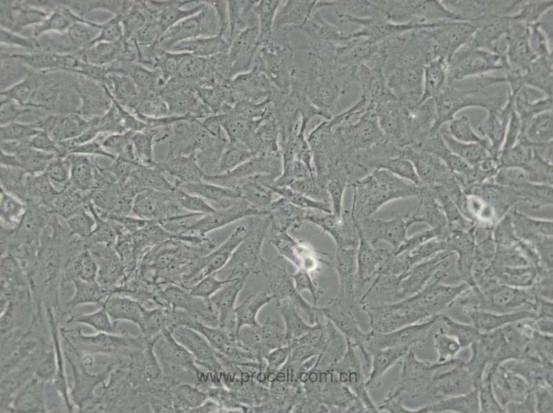 SW579 [SW 579; SW-579] (人甲狀腺鱗癌細胞) (STR鑒定正確)