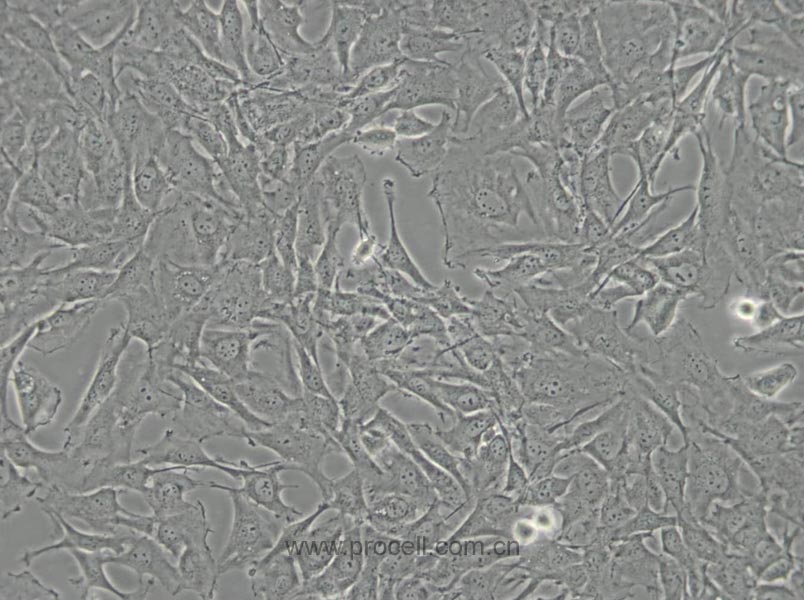SW579 [SW 579; SW-579] (人甲狀腺鱗癌細胞) (STR鑒定正確)