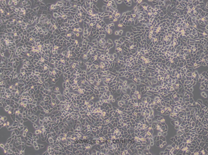 MDA-MB-468 (人乳腺癌細(xì)胞) (STR鑒定正確)