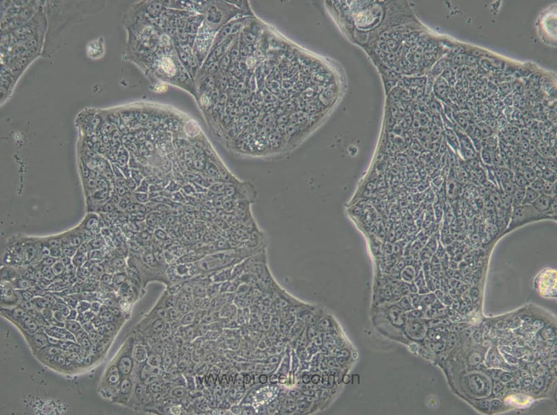 SW1116 (人結(jié)腸腺癌細(xì)胞) (STR鑒定正確)