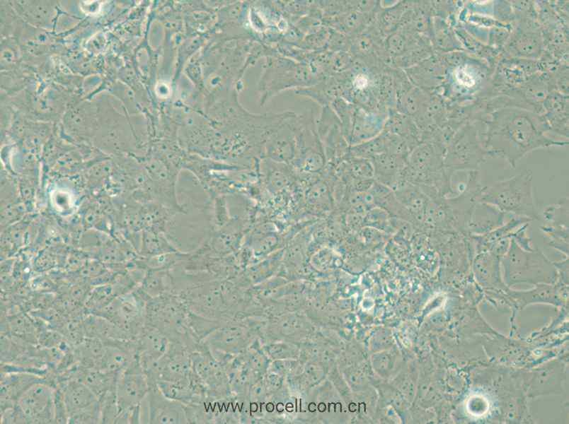 HCC38 (人乳腺導管癌細胞) (STR鑒定正確)