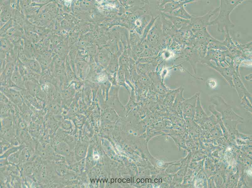 HCC38 (人乳腺導管癌細胞) (STR鑒定正確)