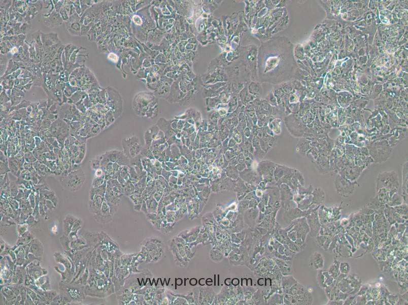 MDA-MB-415 (人乳腺癌細(xì)胞) (STR鑒定正確)